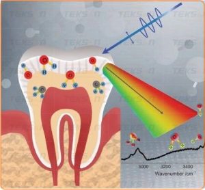 کاربرد طیف‌ سنج رامان در بیماری ‌های حفره دهان