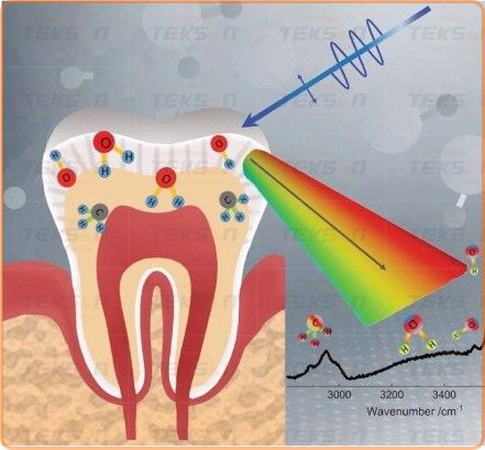 کاربرد طیف‌ سنجی رامان در بیماری ‌های حفره دهان